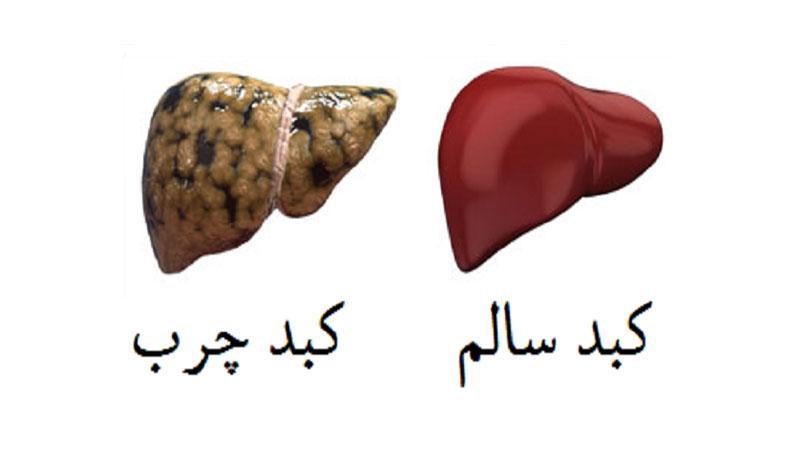 رابطه ویتامین دی با کبد چرب