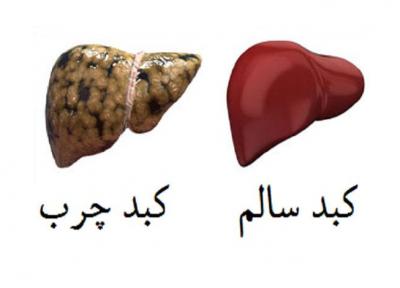 رابطه ویتامین دی با کبد چرب